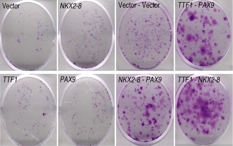 premalignant lung epithelial cells