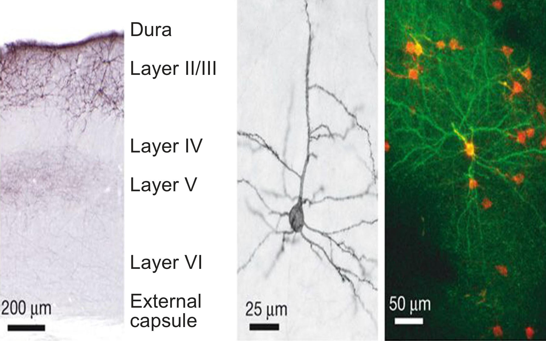 ChR2 assisted photostimulation
