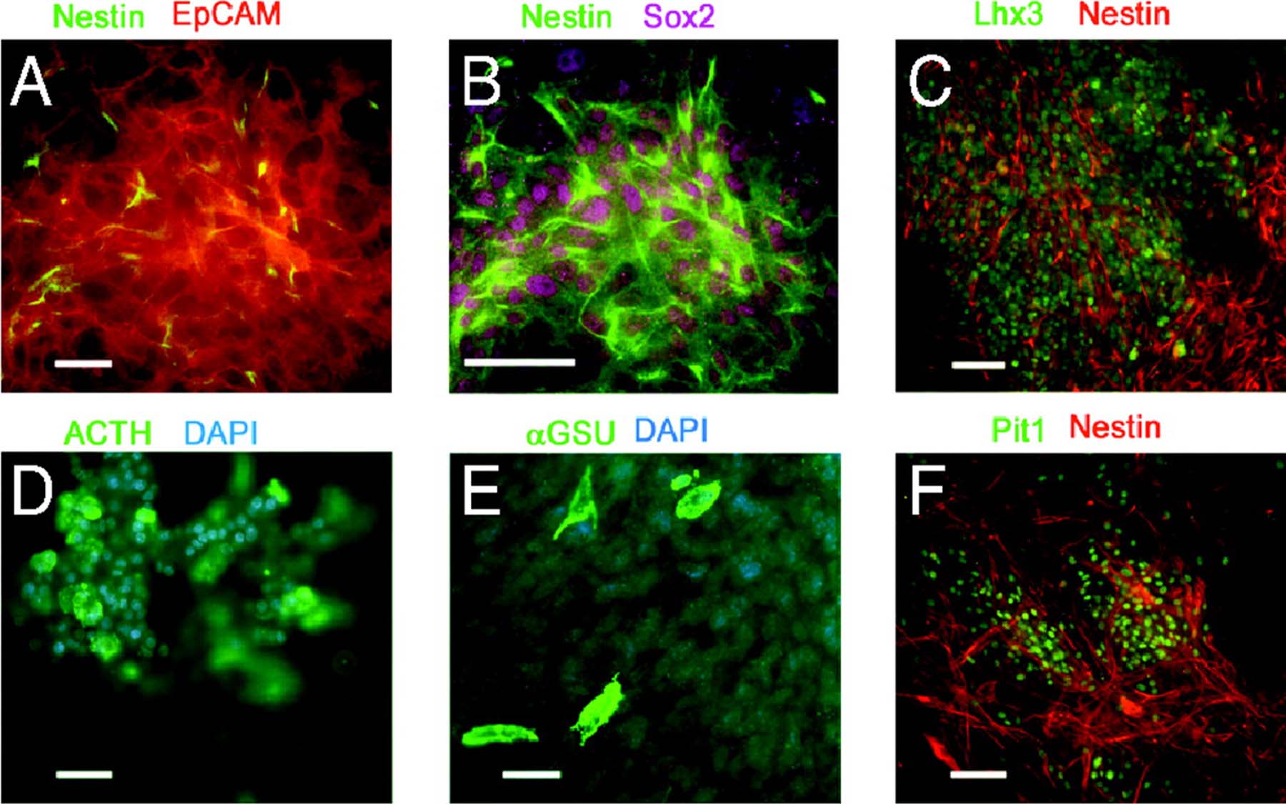 Nestin GFP postive cells