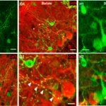 Stellate and Basket Cells