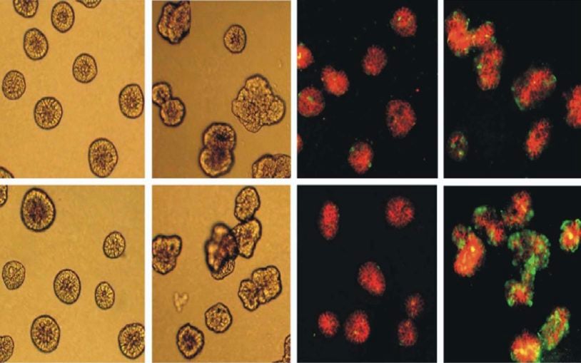 Brk enhances MCF-10A cells