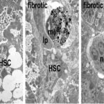 senescent immune cells vitro