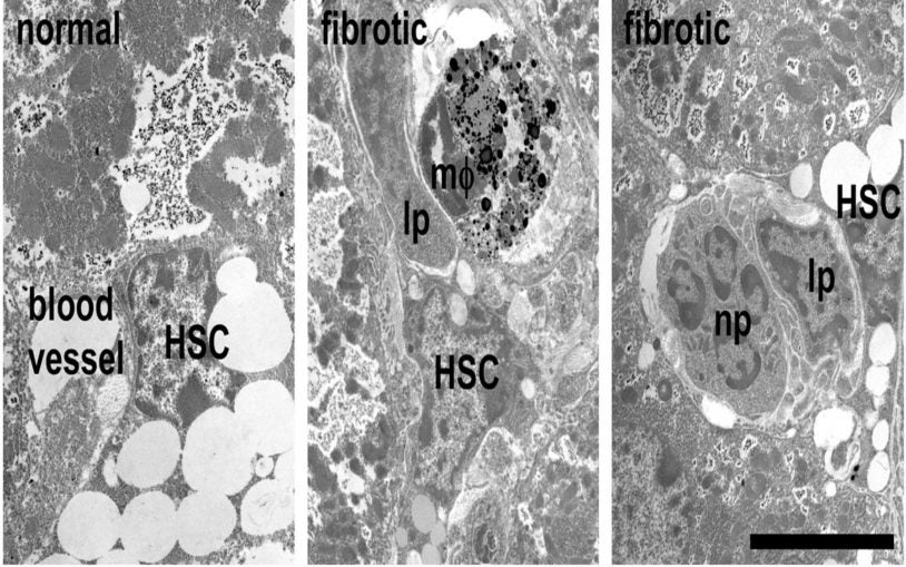 senescent immune cells vitro