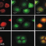 HCC cells infected with Xpo4