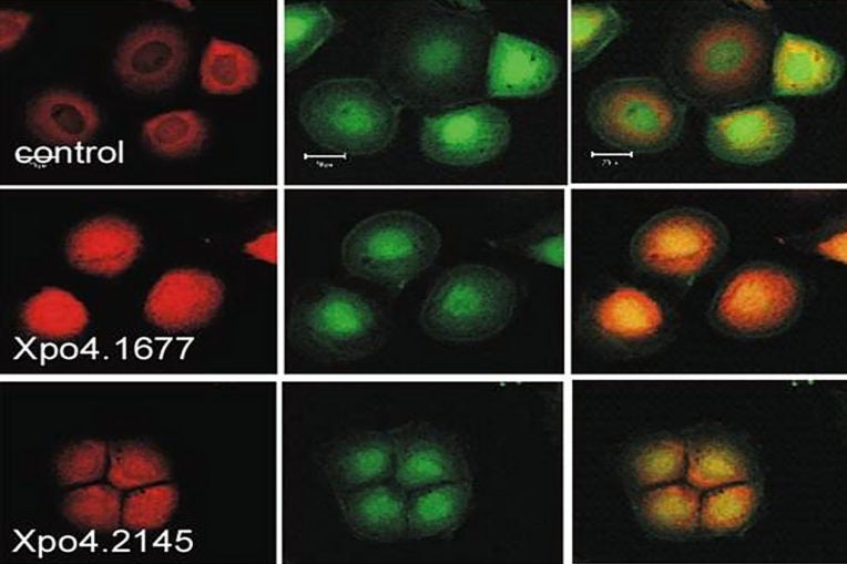 HCC cells infected with Xpo4