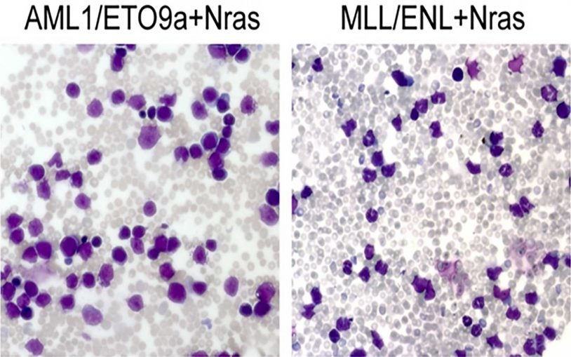 CSHL team develops mouse models of leukemia that accurately predict response to chemotherapy