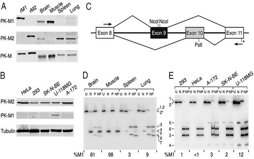 expression patterns of pyruvate kinase M1/M2 isoforms