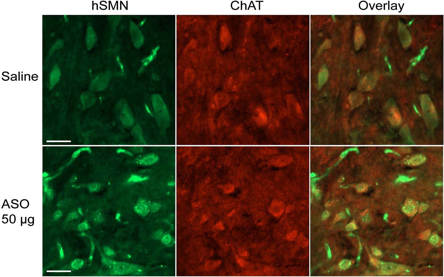 spinal cord protein deletion Krainer