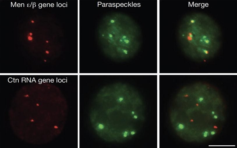 paraspeckles