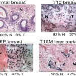 breast cancer genetic diversity