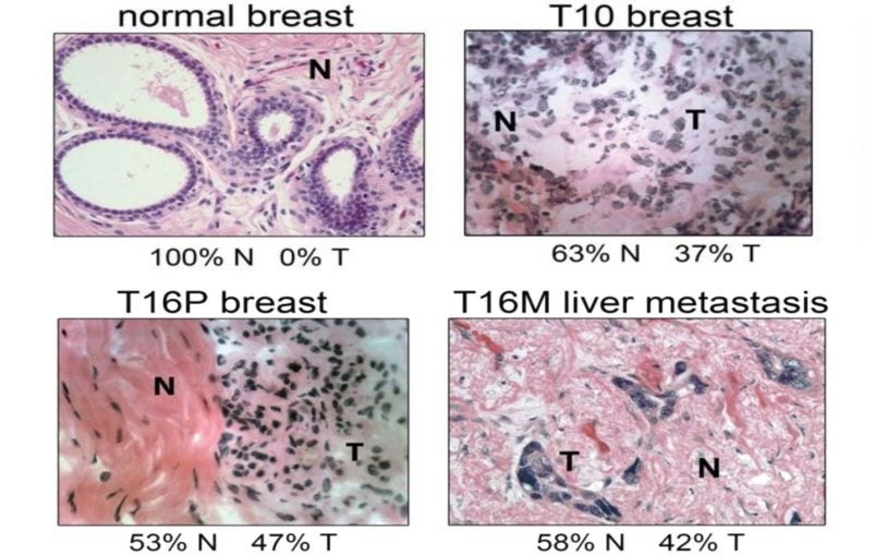 breast cancer genetic diversity