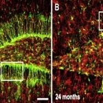 adult brain stem cells