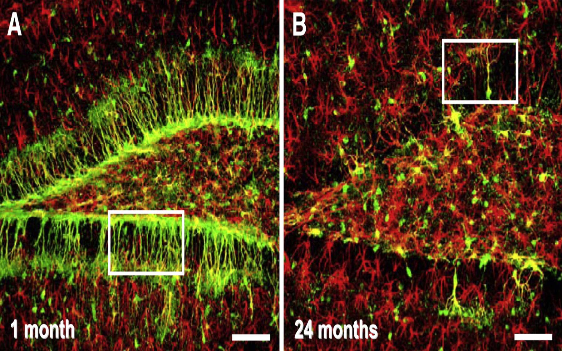 adult brain stem cells