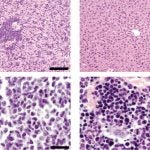 liver and bone marrow