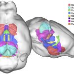 autism brain structure