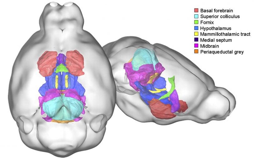 autism brain structure