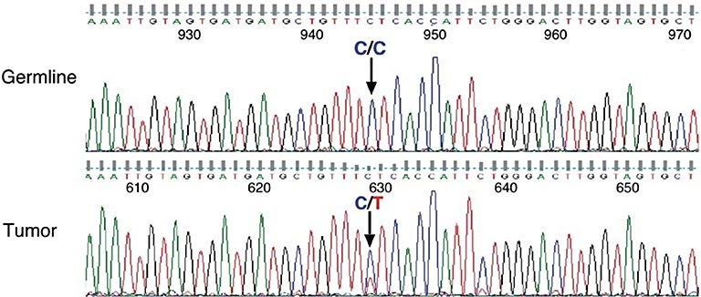 MS4A2 gene chart
