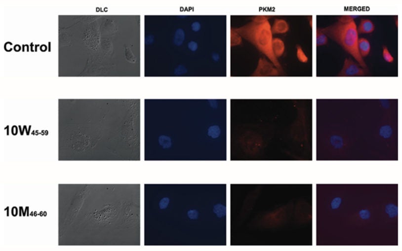 Glioblastoma cells