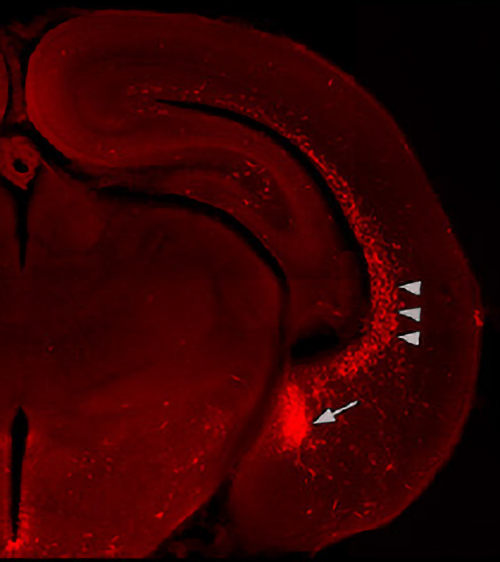 chandelier cell germinal zone