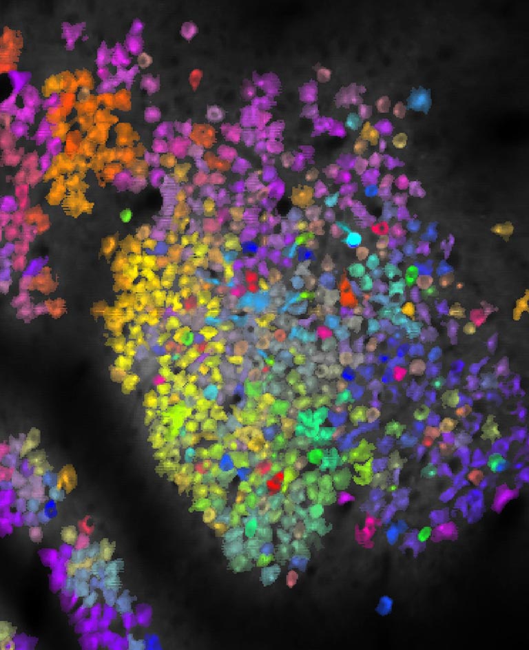 mouse brain
