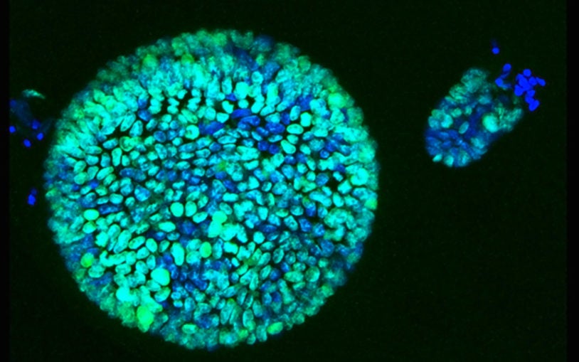 blue organoids