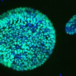 cancer cells
