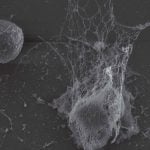 neutrophils