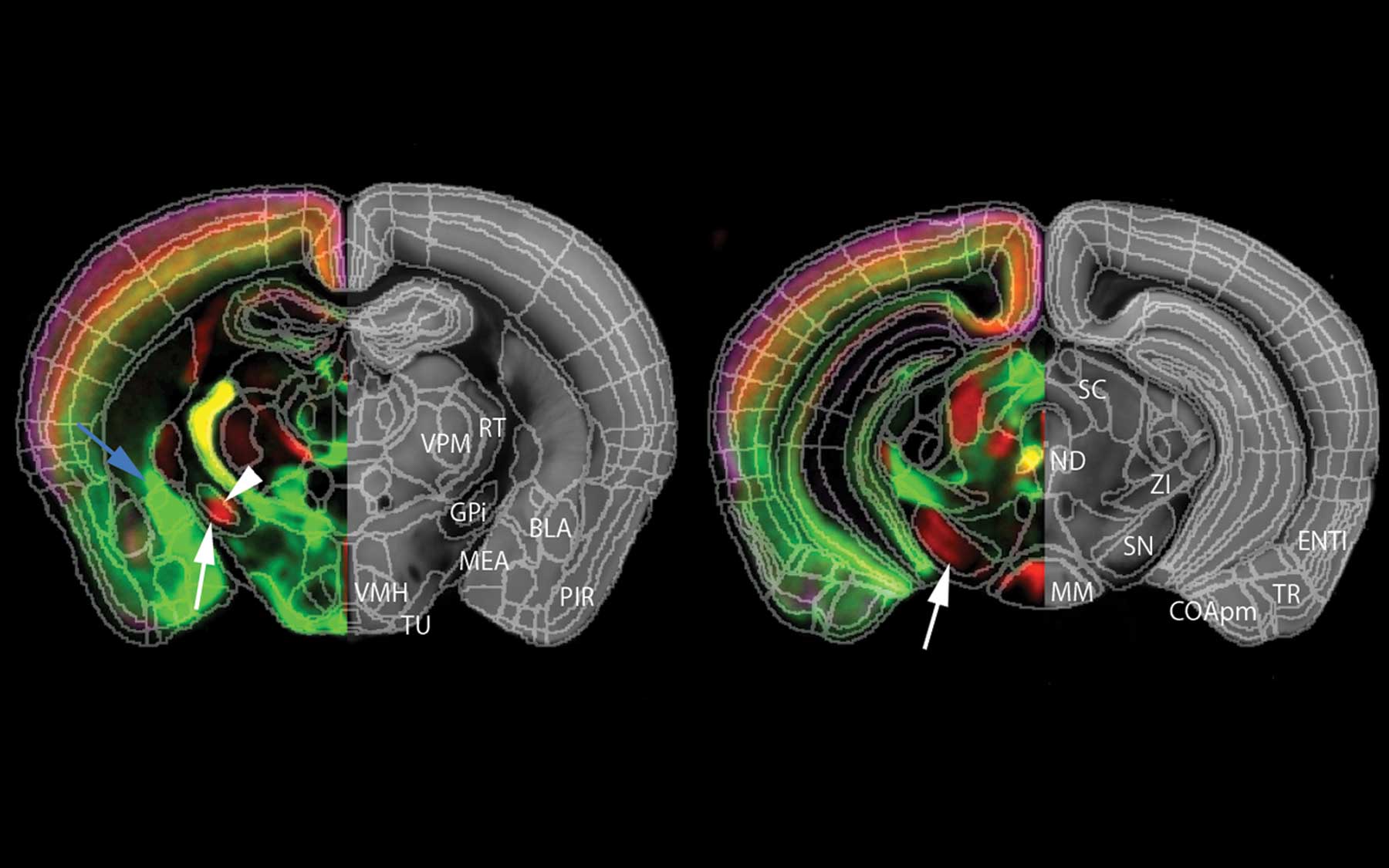 BRAIN initiative