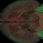 inhibitory cell types, expressing neuropeptides