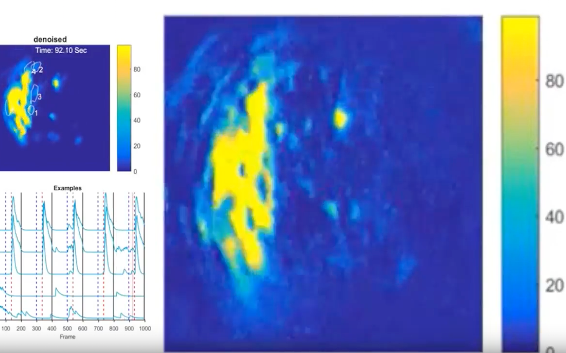 A Halloween treat The neuroscience of fear Cold Spring Harbor Laboratory
