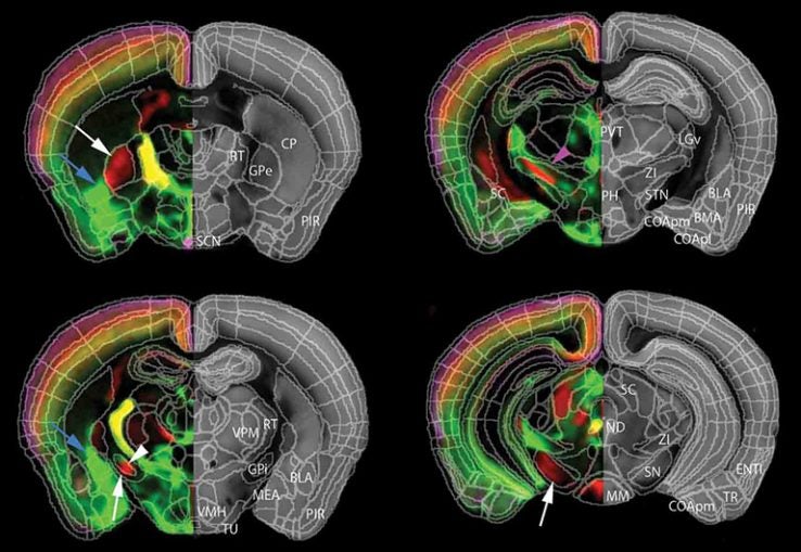 Establishing new TReNDS in brain research - The Signal