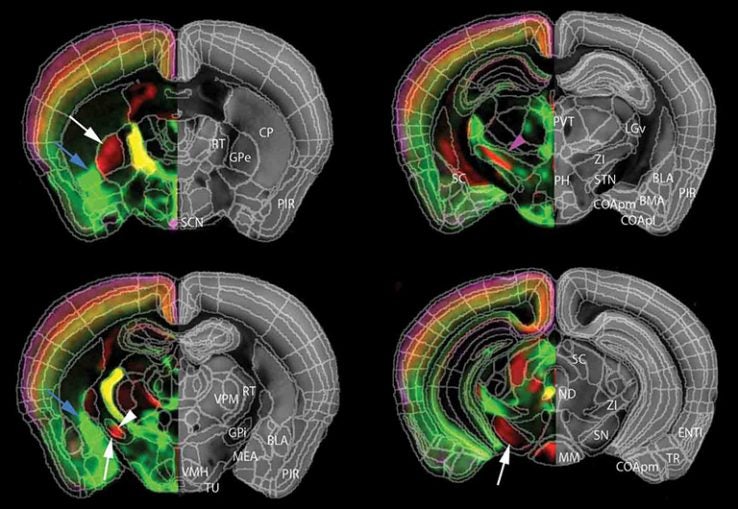 neuroscience qBrain mapping