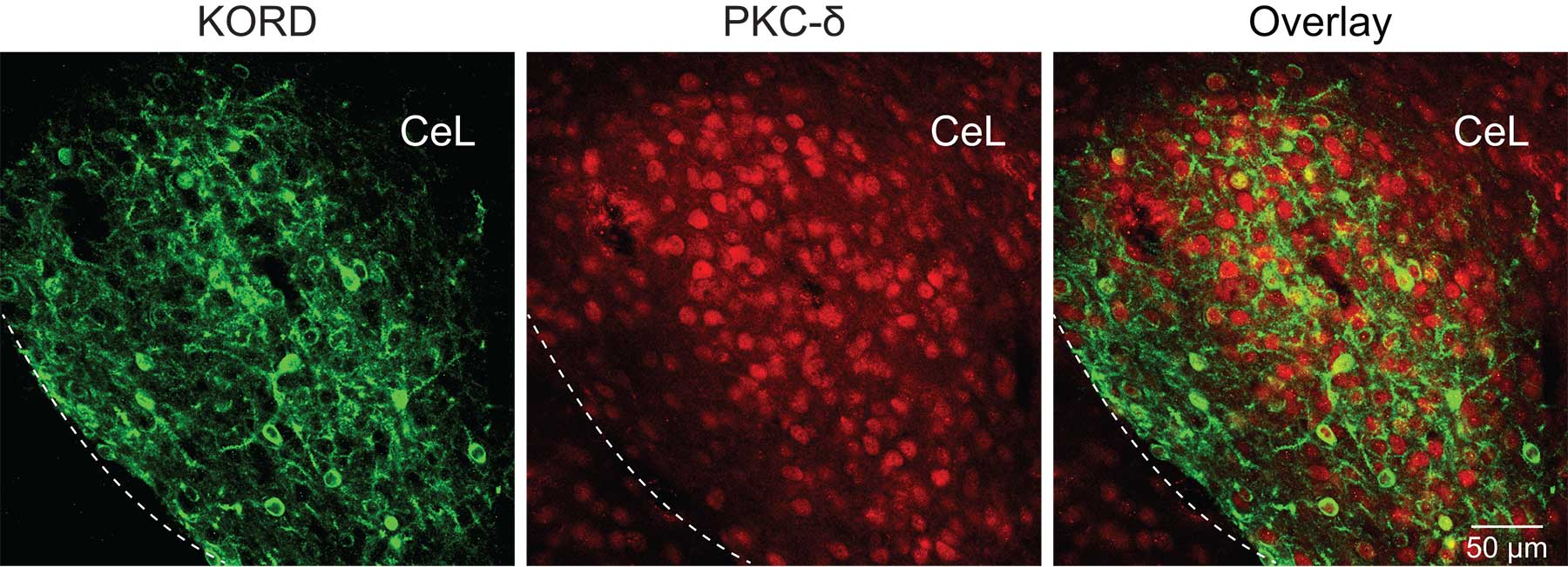 PKC delta-expressing cells