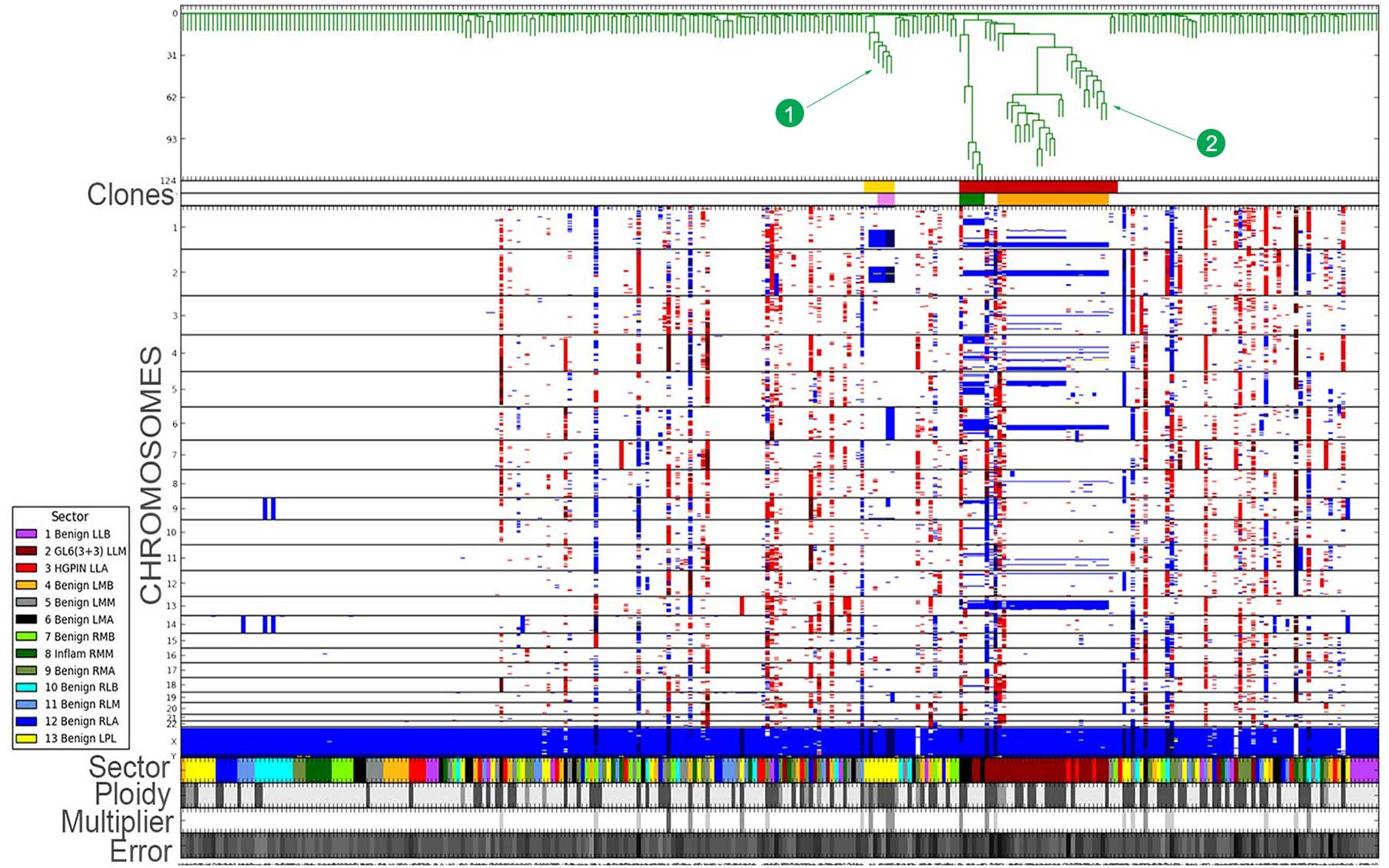 diagnostic prostate biopsy results