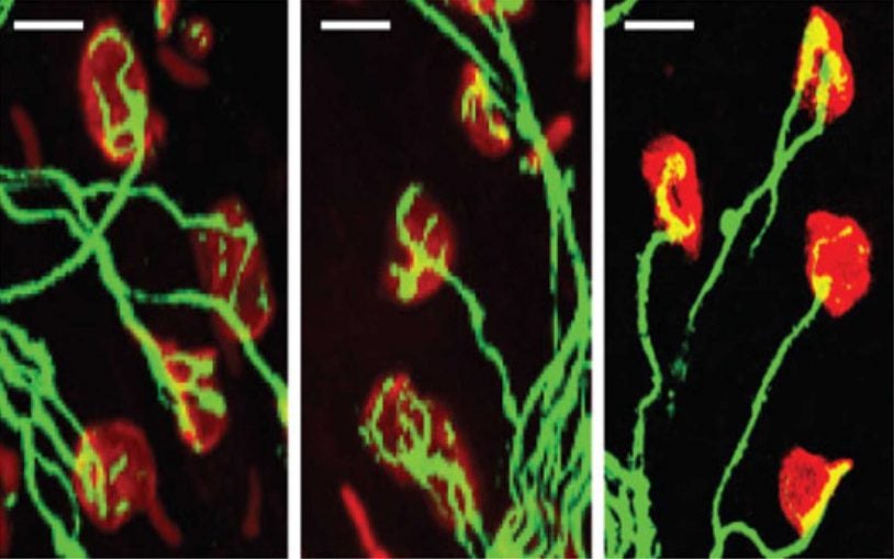 Candidate drug for spinal muscular atrophy, with roots in CSHL research, passes major hurdle