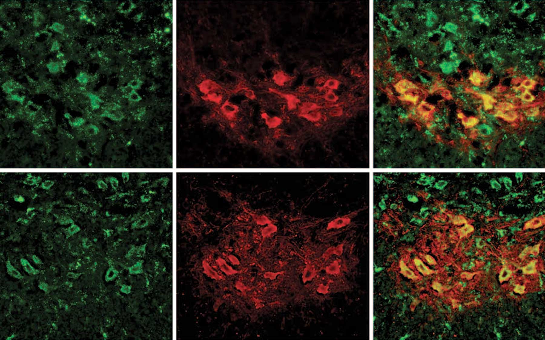 mouse motor neurons