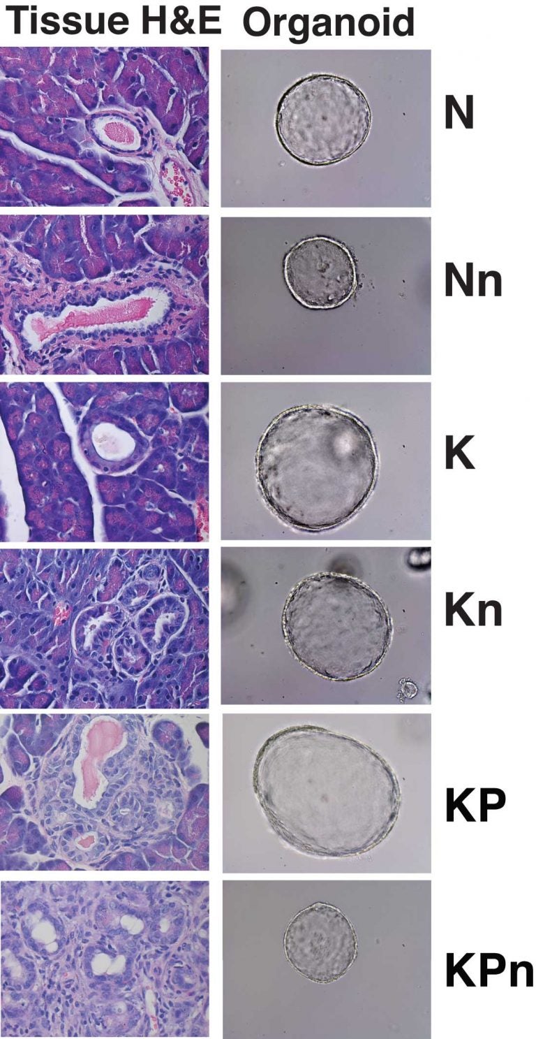 pancreas organoids