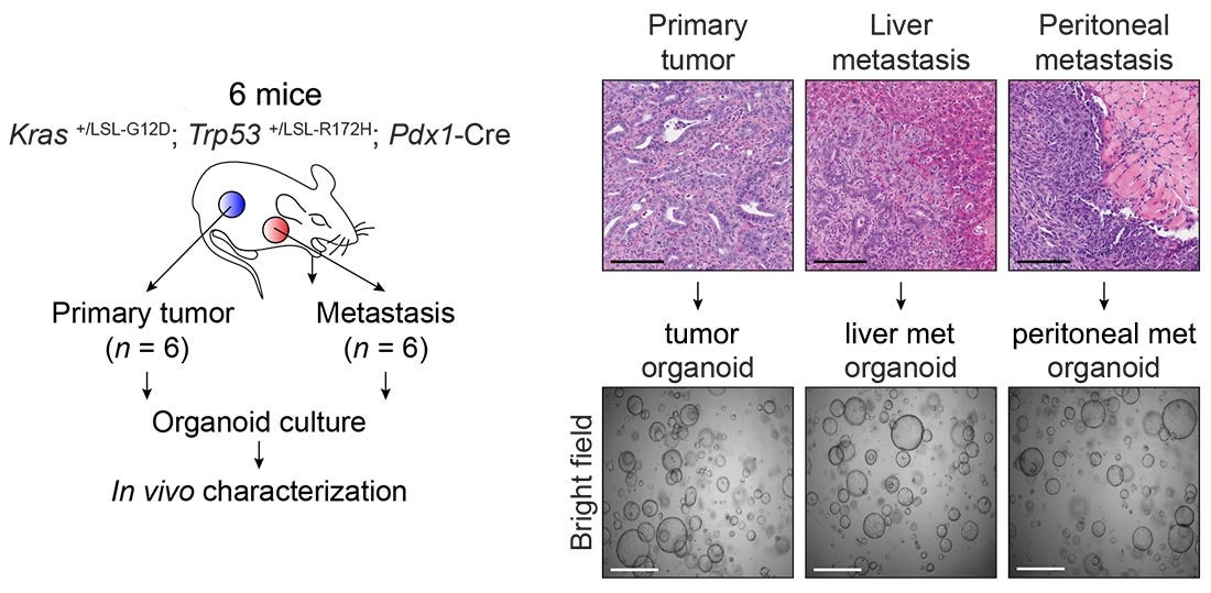 pancreatic cancer metastasis in mice