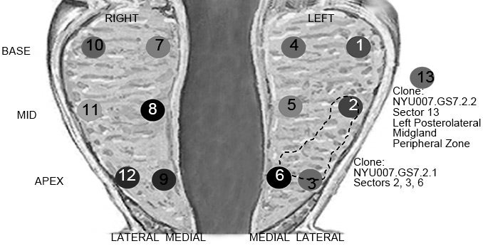 human prostate gland