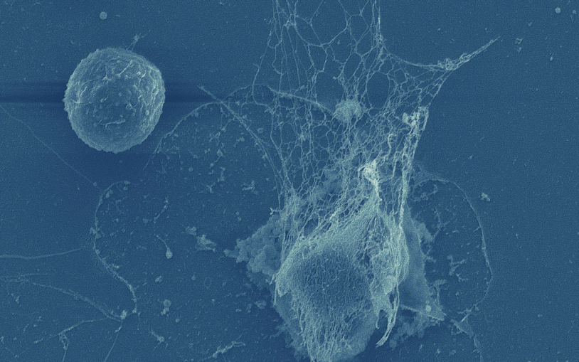 Public lecture: METASTASIS & IMMUNITY How immune cells can help cancer spread, or stop it in its tracks