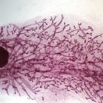 breast tissue