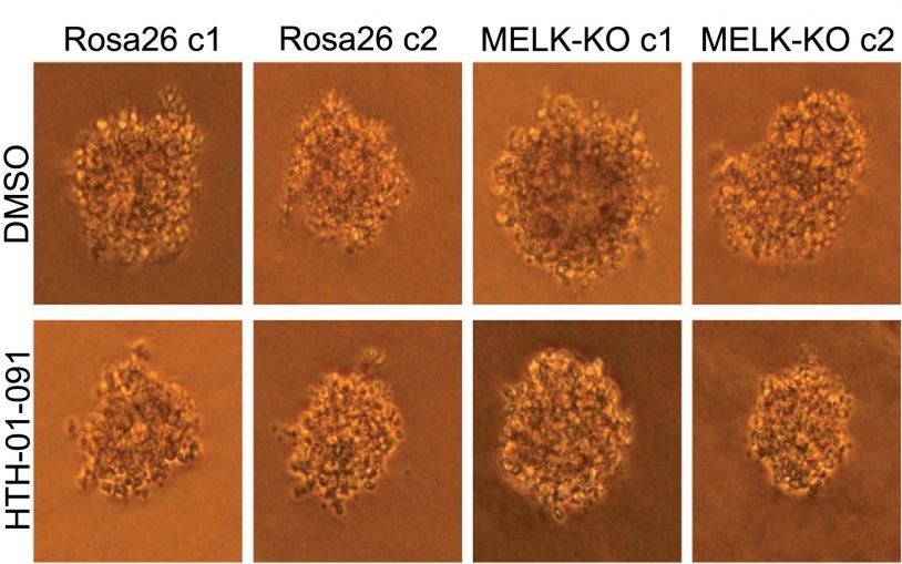 human colon cancer cells