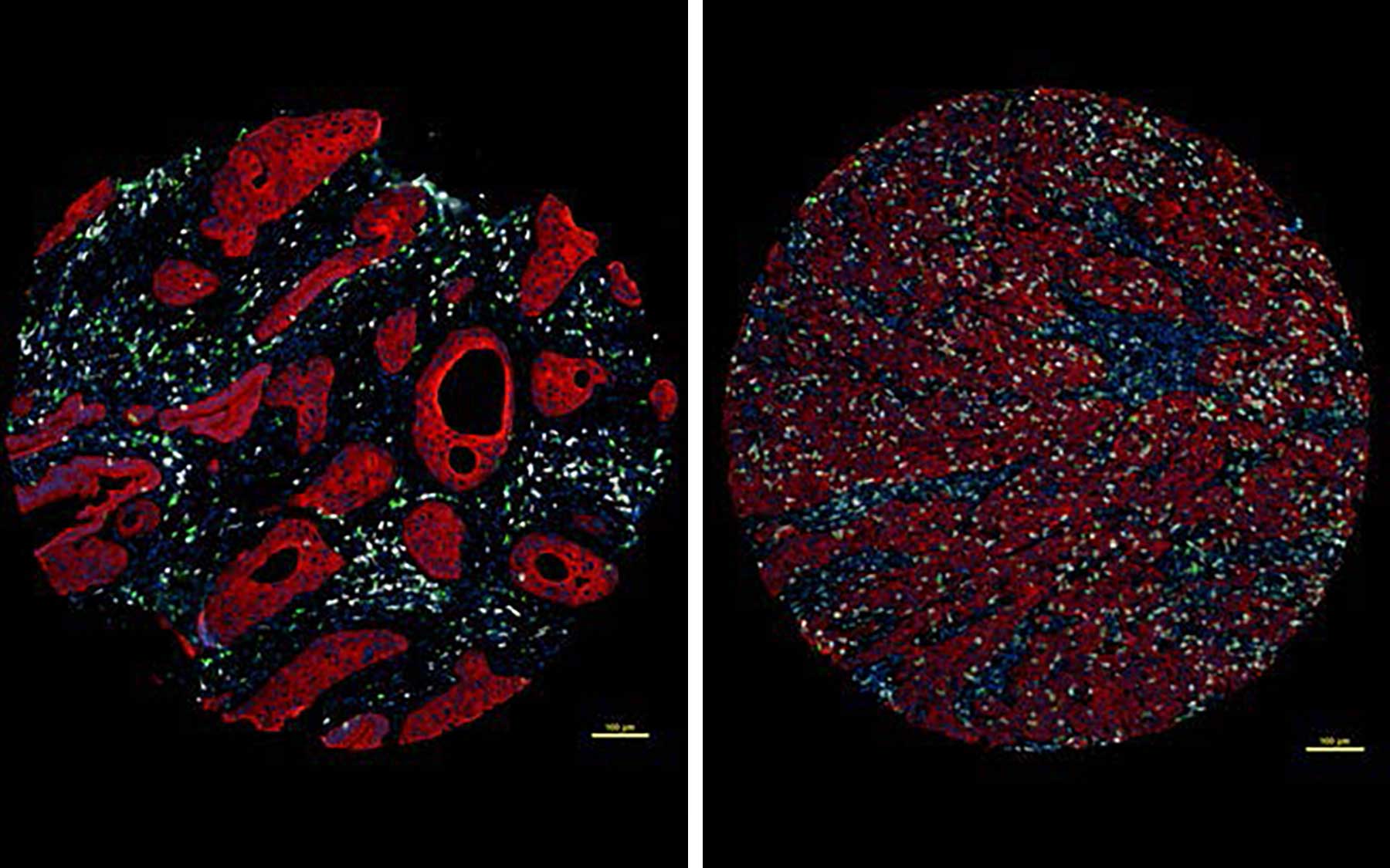 fibroblasts