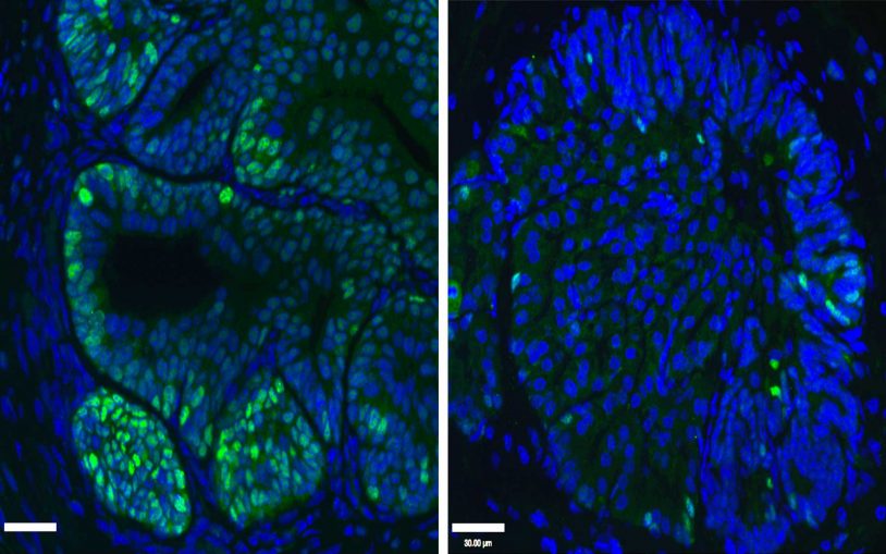 cancerous mouse prostate cells