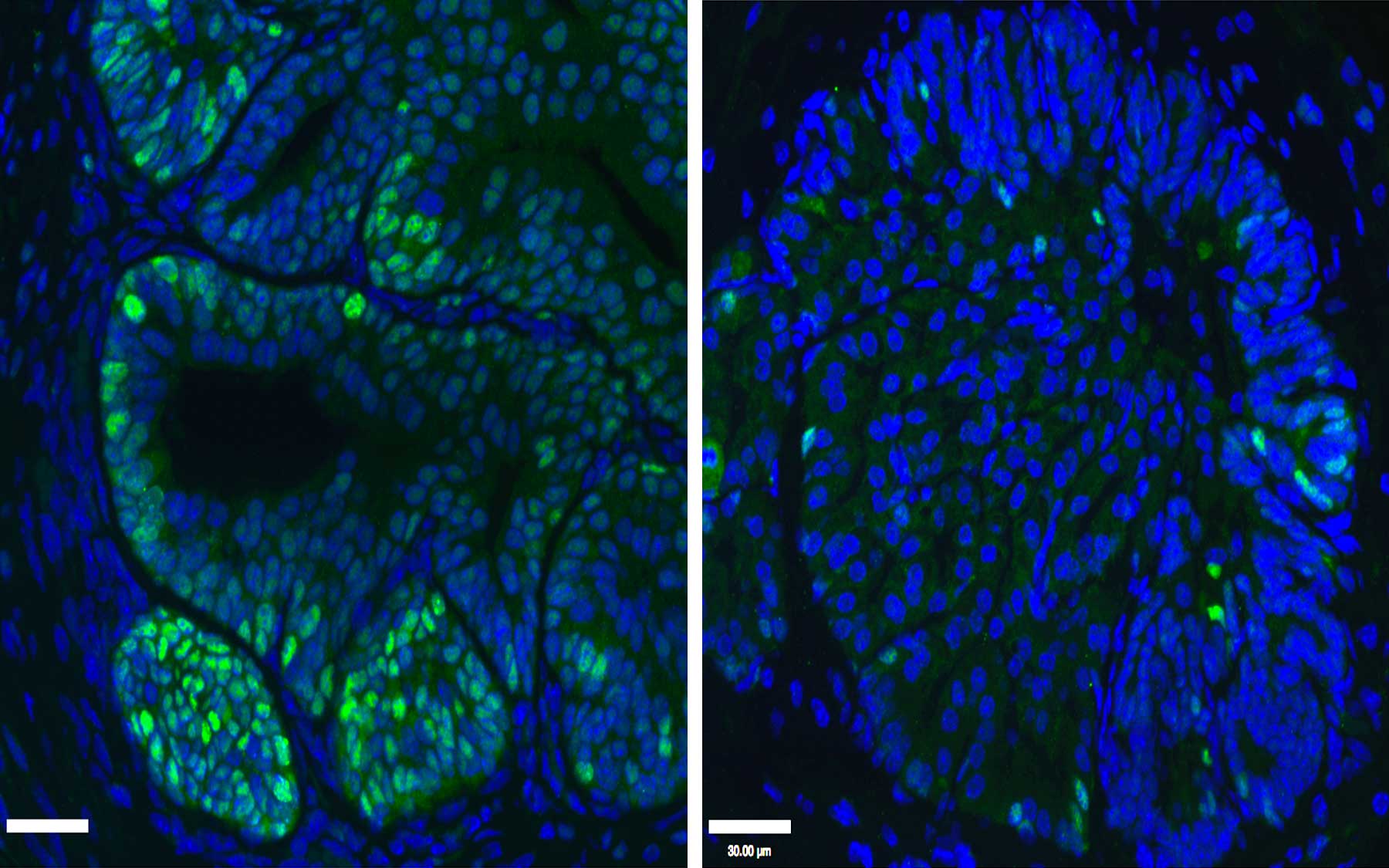 cancerous mouse prostate cells