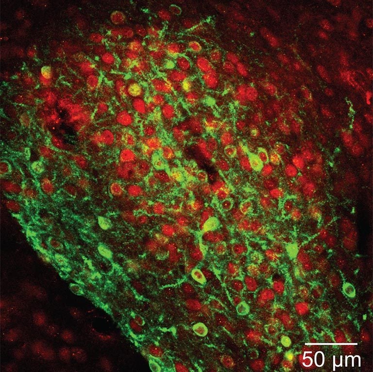 central amygdala