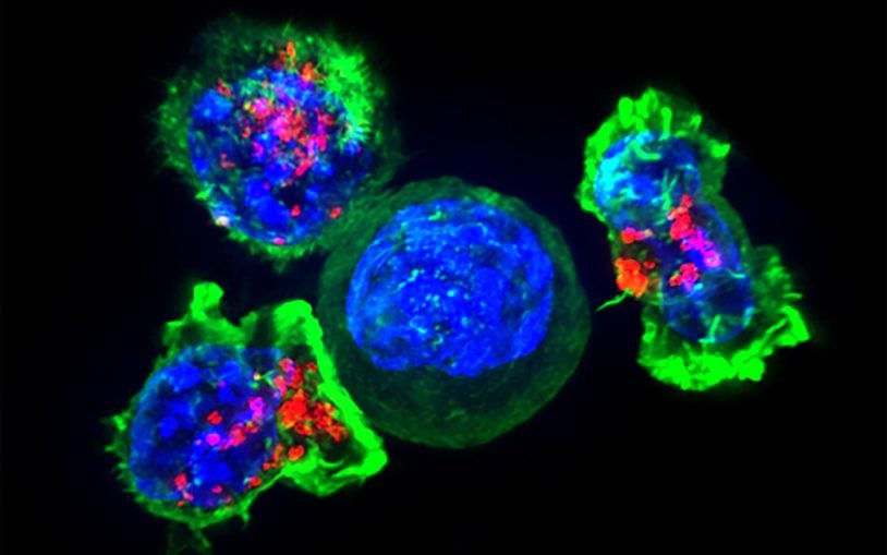 Killer T cells surround a cancer cell