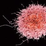 natural killer T cell