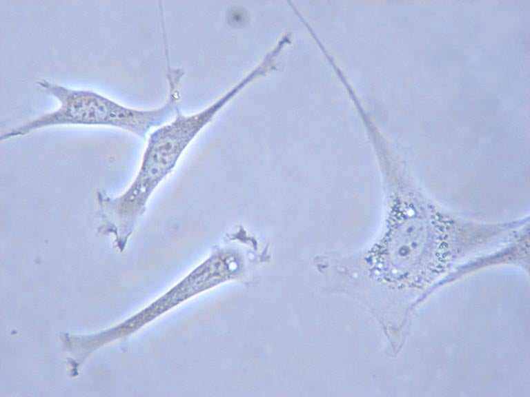 mouse embryo fibroblasts