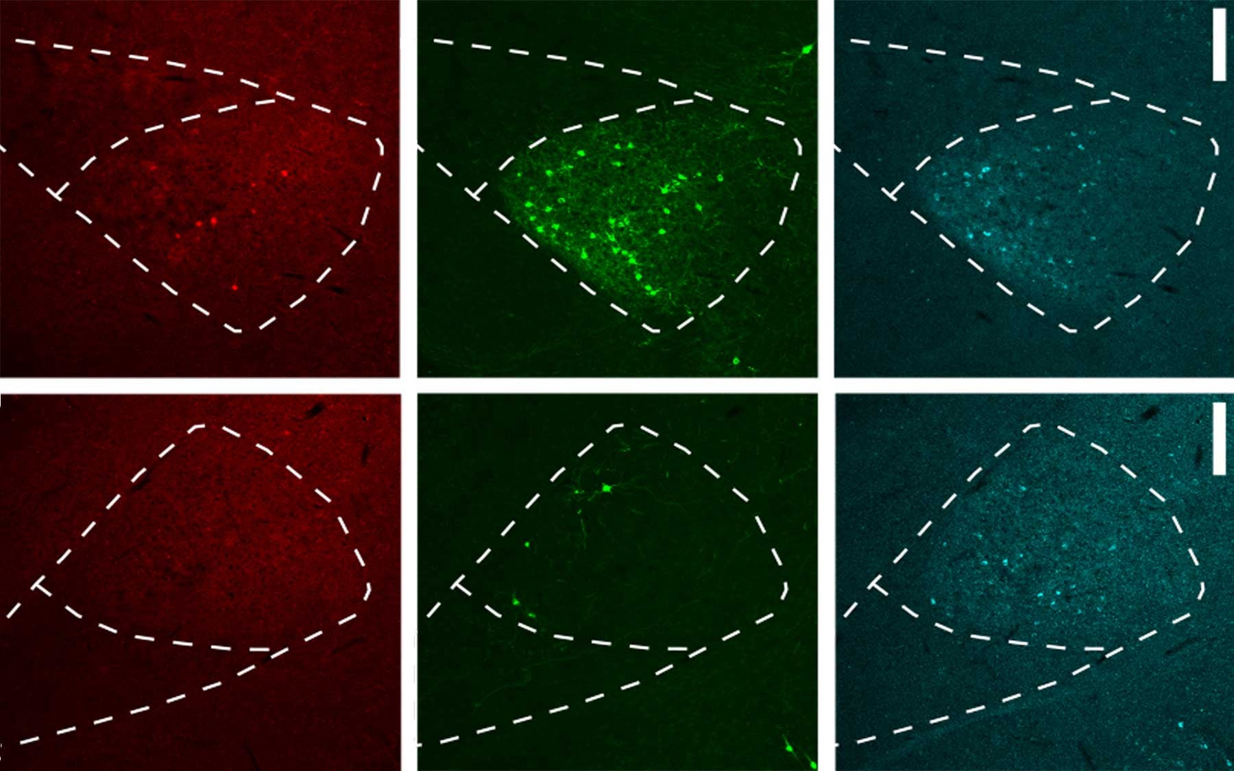 retrograde viral tracing method